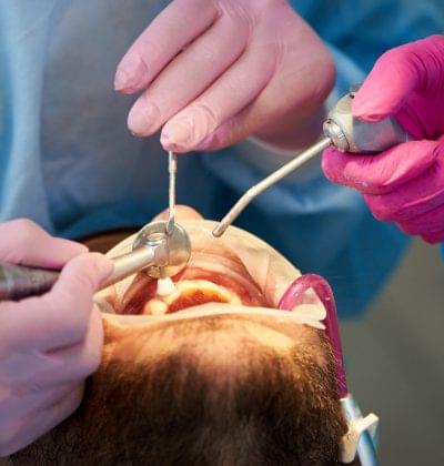 Closeup of a scaling and polishing procedure performed by two dentists. Closeup of a scaling and polishing procedure performed by two dentists in pink gloves to a male client.
